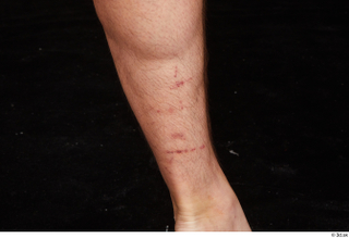 Louis calf nude scar 0001.jpg